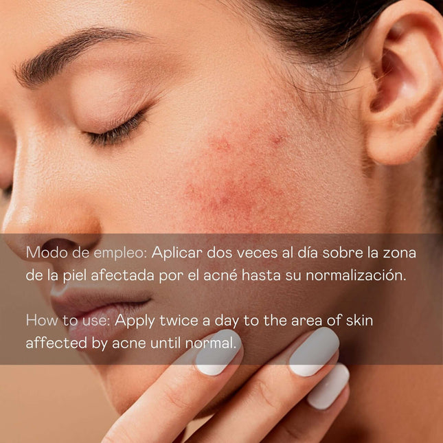 Sérum antiimperfecciones facial 30 ml | acción intensiva