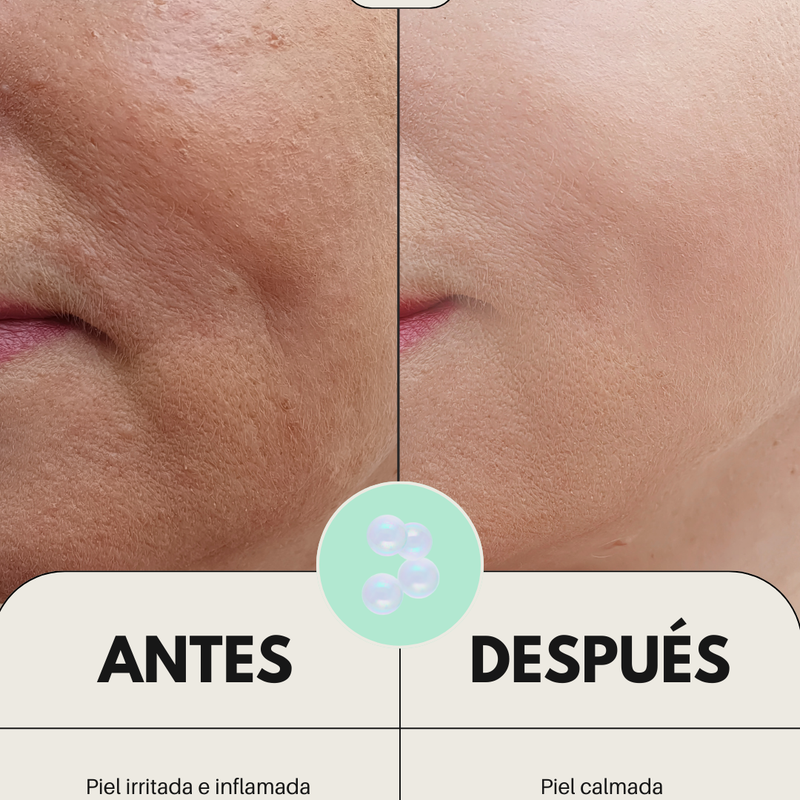 Rutina facial para piel sensible con fórmulas suaves