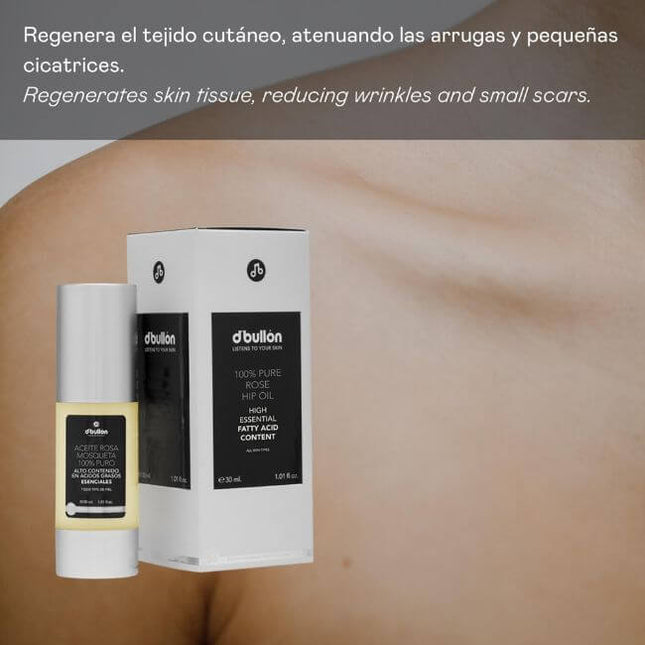 Aceite de rosa mosqueta puro 30 ml para piel radiante